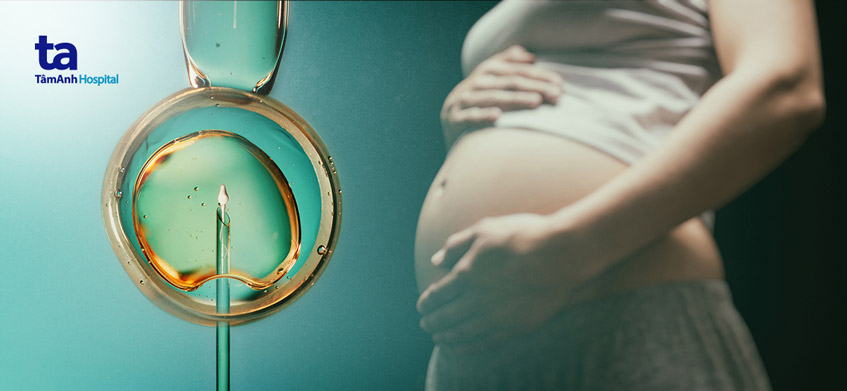 minh họa kỹ thuật icsi