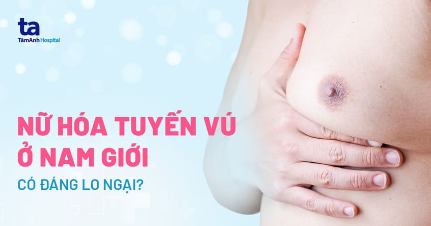 Nữ hóa tuyến vú: Nguyên nhân, dấu hiệu, điều trị và phòng ngừa