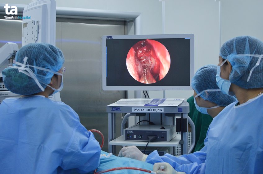 phẫu thuật xâm lấn chữa viêm xoang