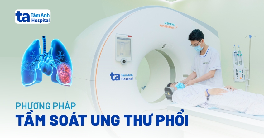 Tầm soát ung thư phổi: Các phương pháp và quy trình khám chẩn đoán