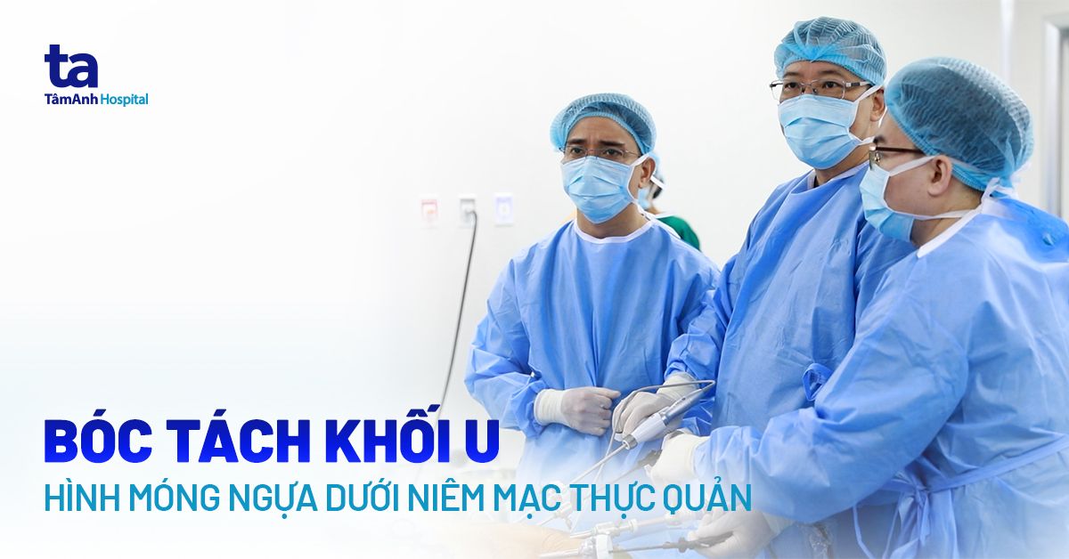 Bóc tách khối u 4 cm hình móng ngựa ở thực quản