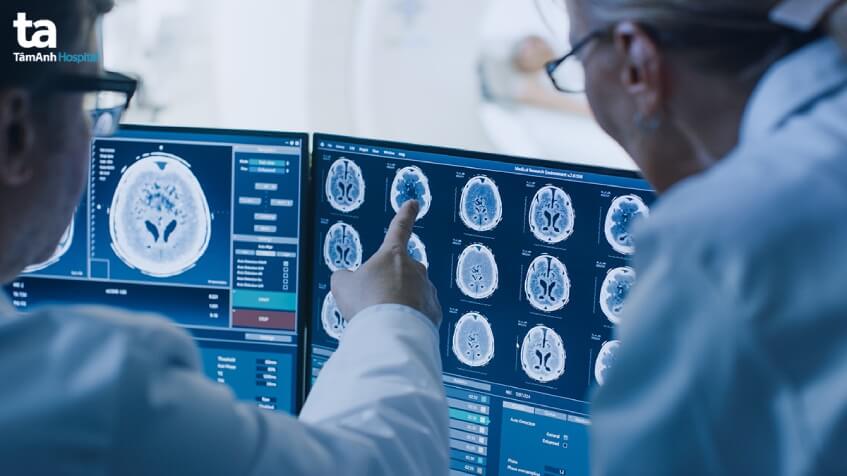 u tuyến tùng là gì