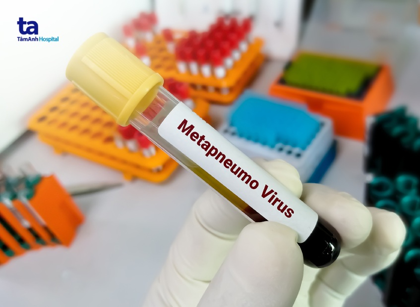 xét nghiệm Viêm đường hô hấp do Metapneumovirus