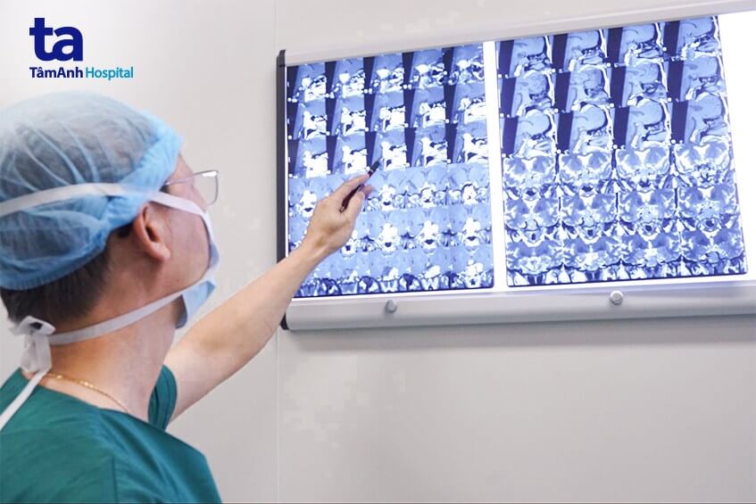 bác sỹ phân tích hình ảnh khối u tuyến yên