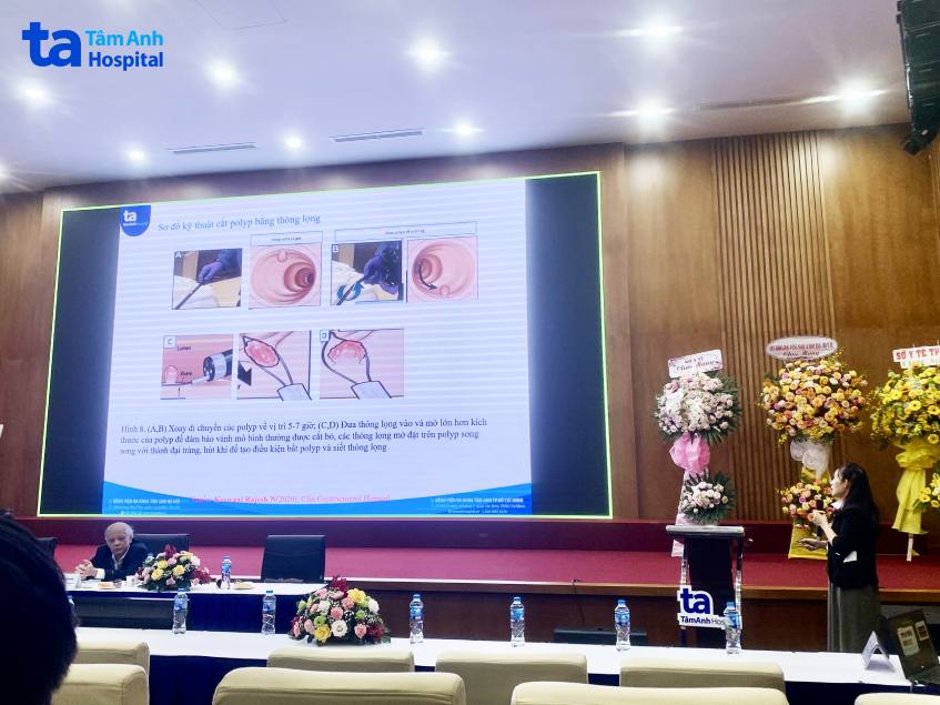 báo cáo của BS Thủy