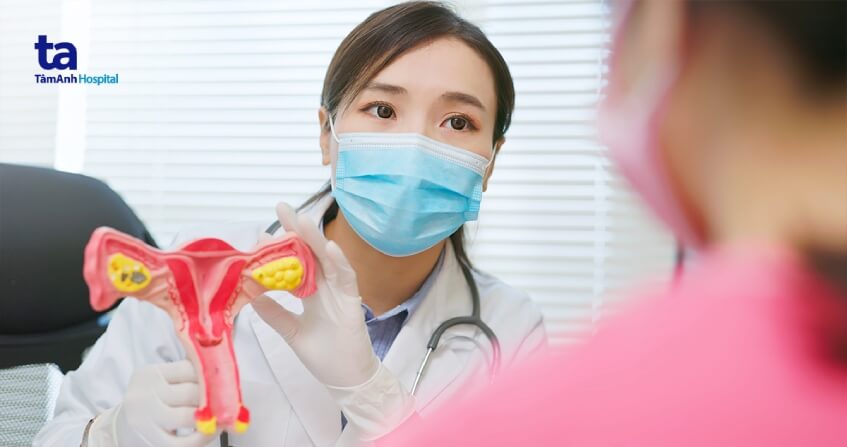 chẩn đoán ung thư buồng trứng