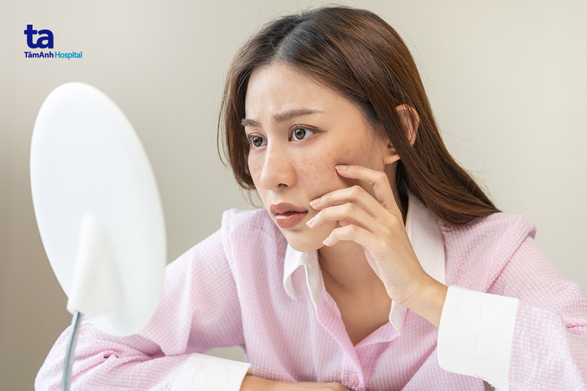 gặp phải một số vấn đề ở da