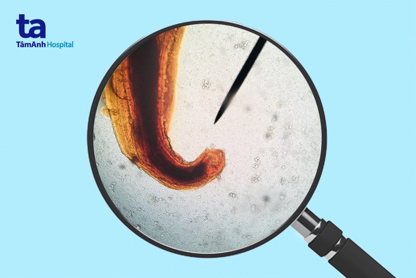 giun móc có nguy hiểm không