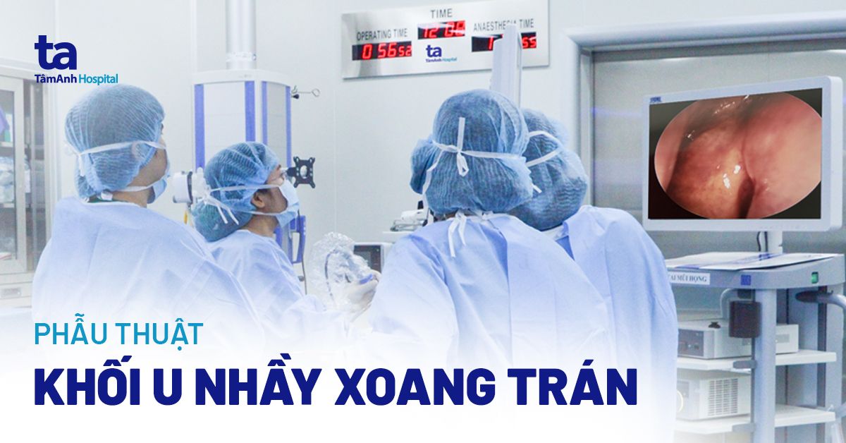 Bỗng mù mắt trái sau 4 tháng té chấn thương hàm mặt