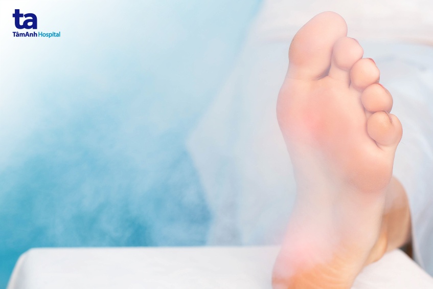 phương pháp điều trị mụn cóc ở chân