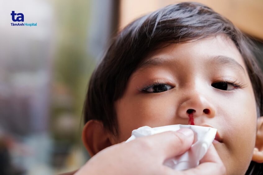 sơ cứu cầm máu