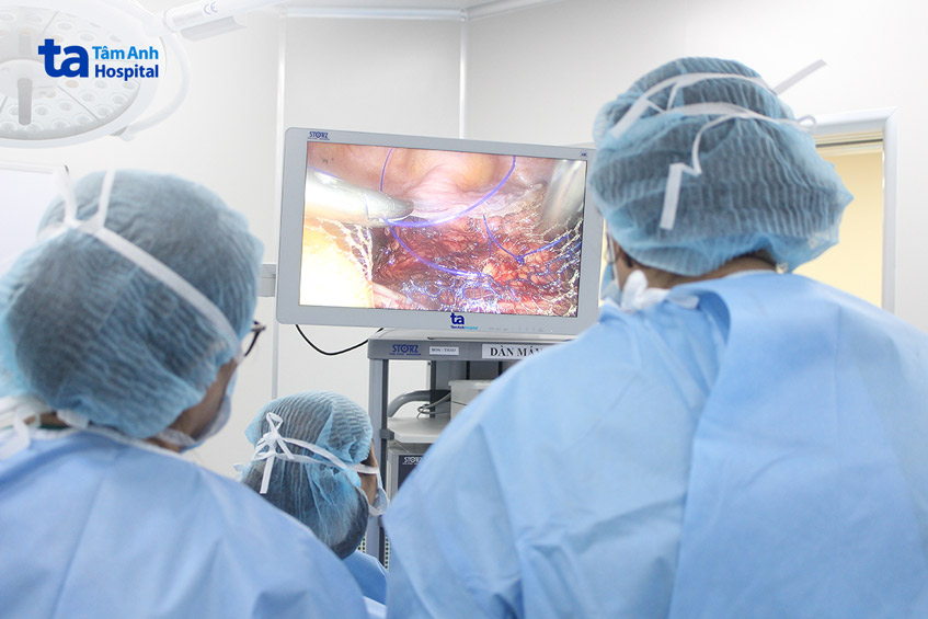 Camera sắc nét hỗ trợ phẫu thuật 