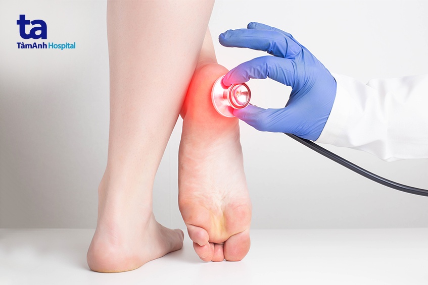 Bác sĩ đưa ra chẩn đoán nhiễm trùng bàn chân tiểu đường