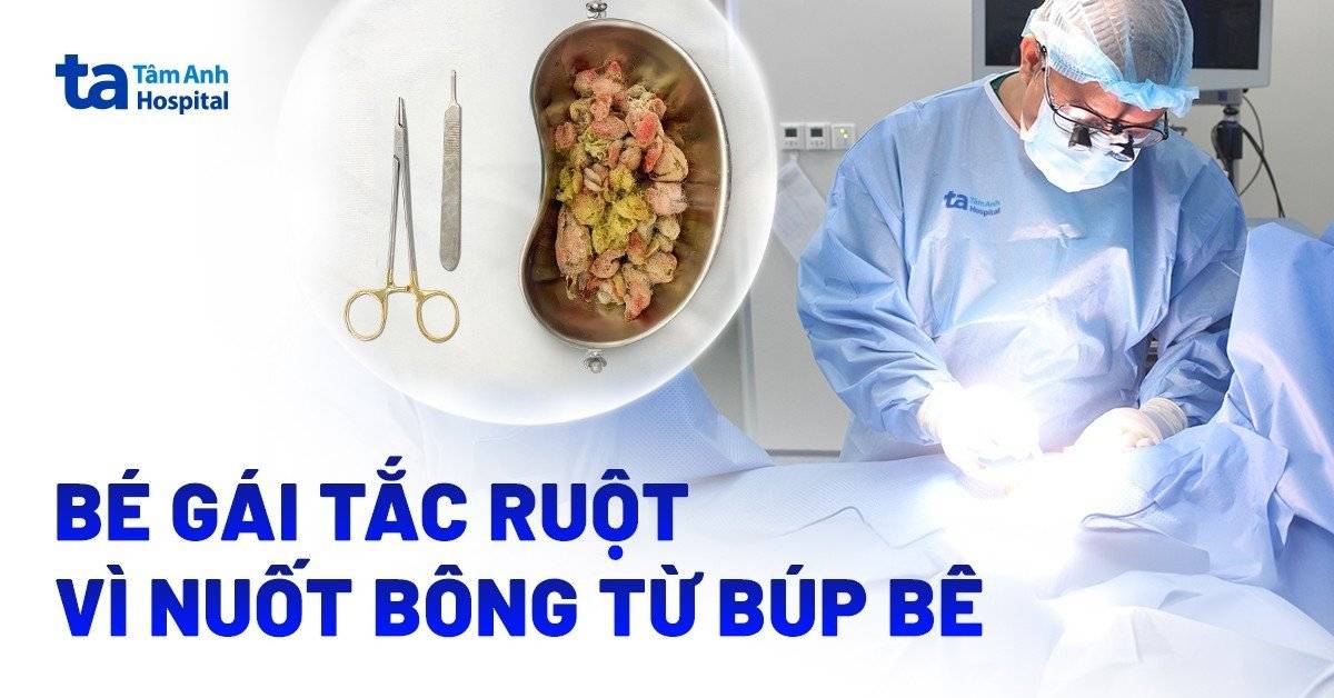 Bé gái 4 tuổi tắc ruột vì ăn ruột bông gòn