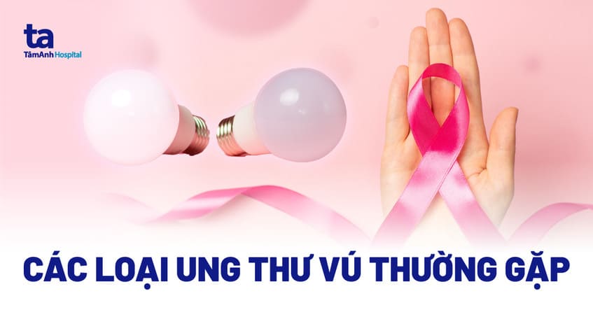 Các loại ung thư vú phổ biến và một số loại hiếm gặp cần biết