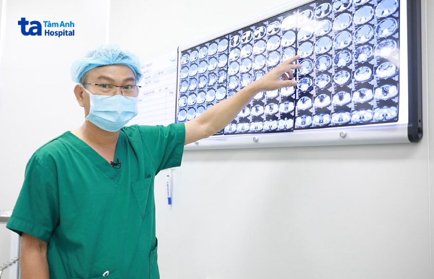 chẩn đoán nang giả tụy