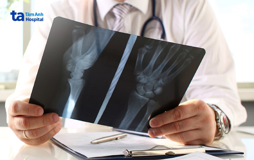 chụp x quang tay có rủi ro không