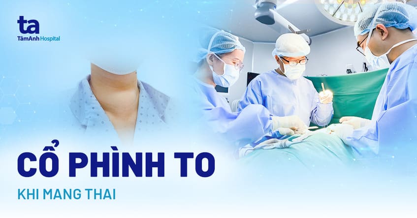 Cổ phình to khi đang mang thai