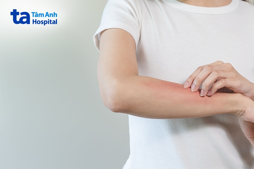 dị ứng thời tiết bao lâu thì khỏi