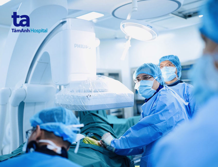 điều trị nhịp nhanh thất bằng cắt đốt