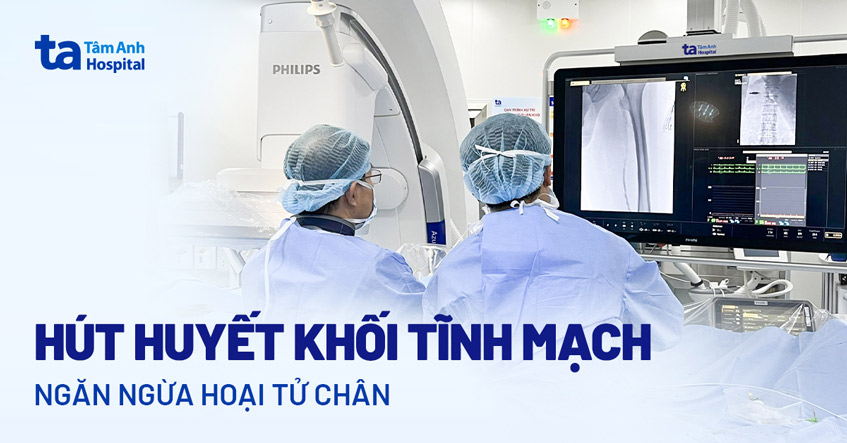 hút huyết khối tĩnh mạch 