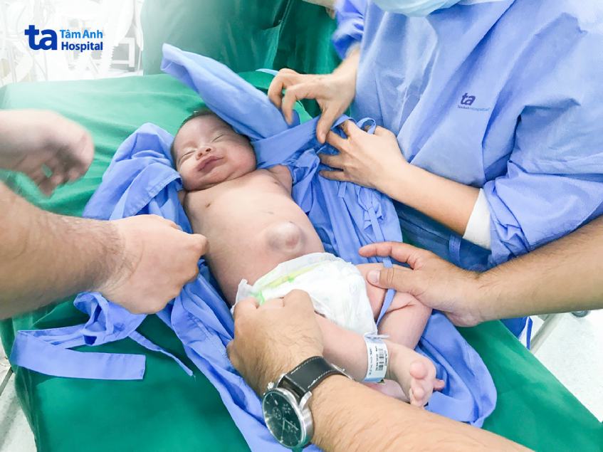 Khối thoát vị to như quả trứng nằm trên ổ bụng