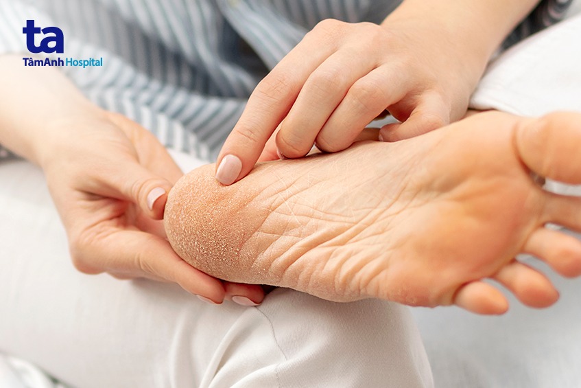 Kiểm tra bàn chân thường xuyên thành thói quen hàng ngày