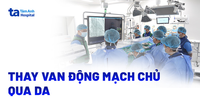 Thay van động mạch chủ qua da cho cụ bà 68 tuổi