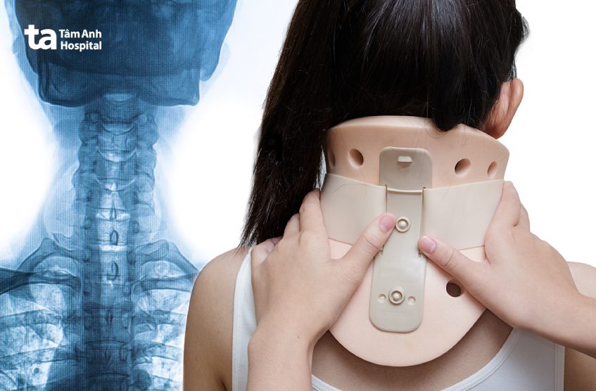 kỹ thuật chụp x quang cột sống cổ