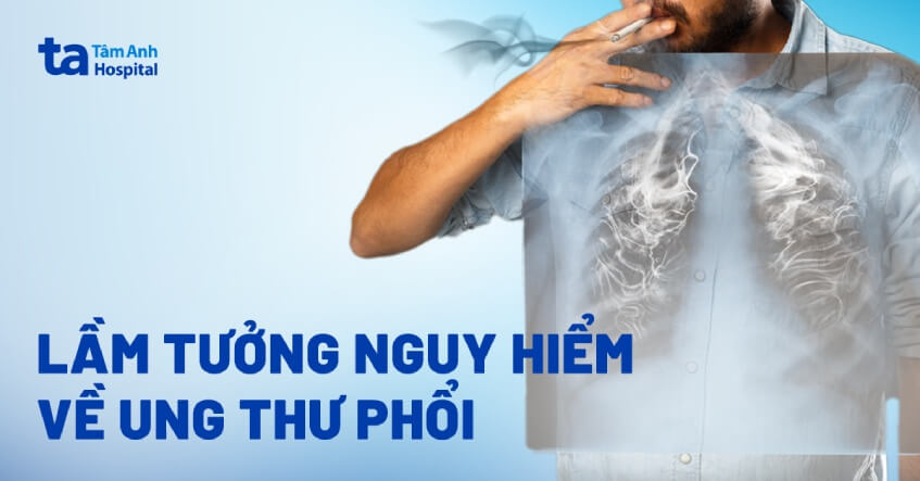 lầm tưởng về bệnh ung thư phổi