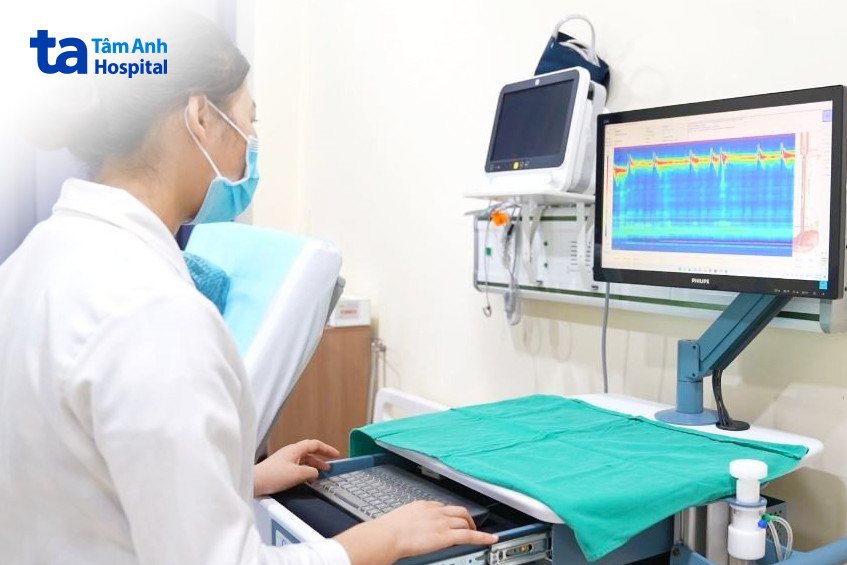 máy đo thực quản