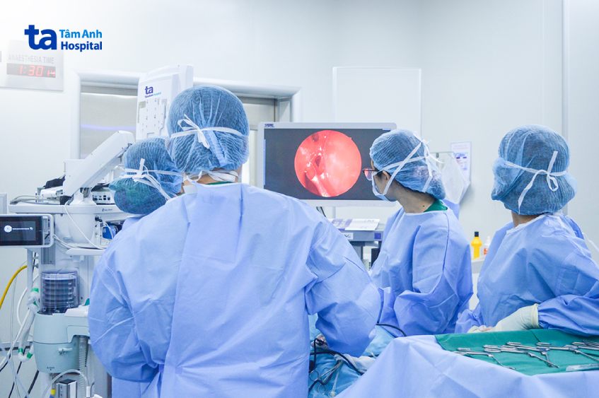 phẫu thuật viêm mũi vận mạch