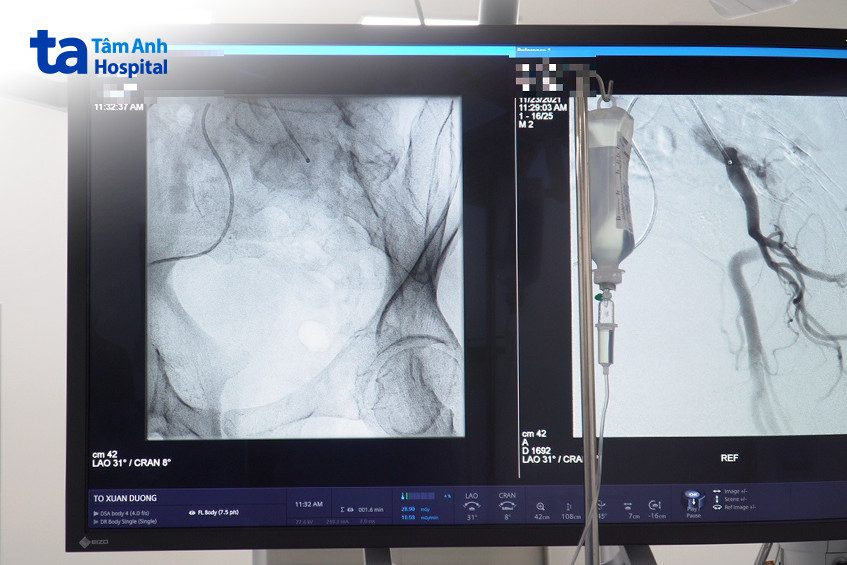 quy trình thực hiện