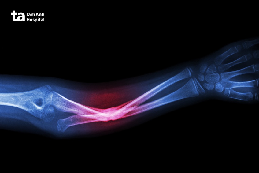 quy trình x quang tay