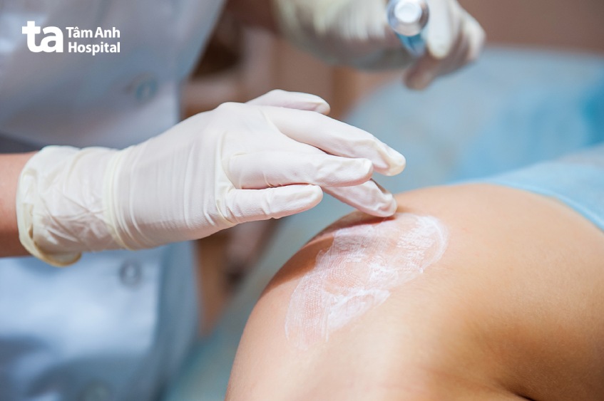 Thuốc gây tê cục bộ ở dạng bôi