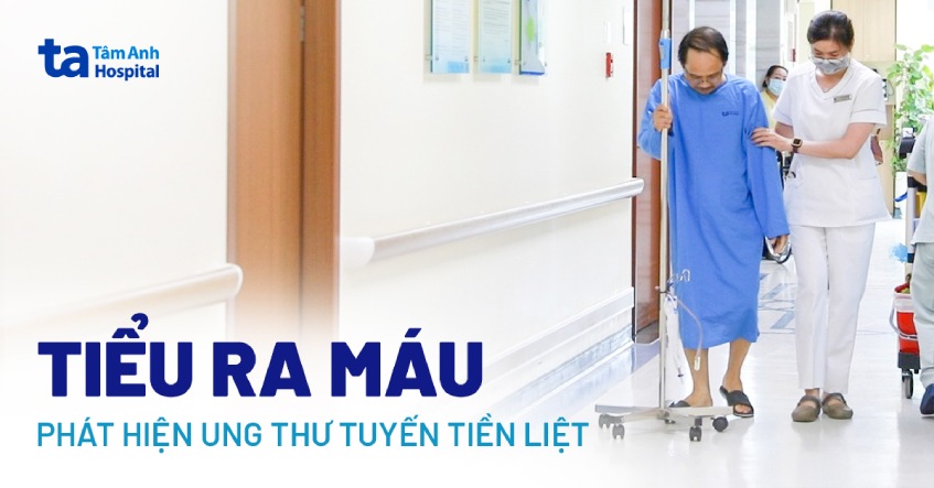 tiểu ra máu phát hiện ung thư tuyến tiền liệt