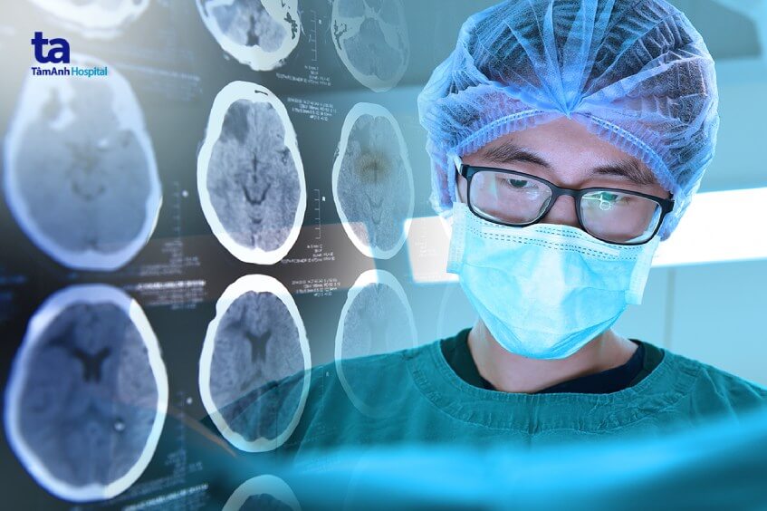 tụ máu não và cách điều trị 