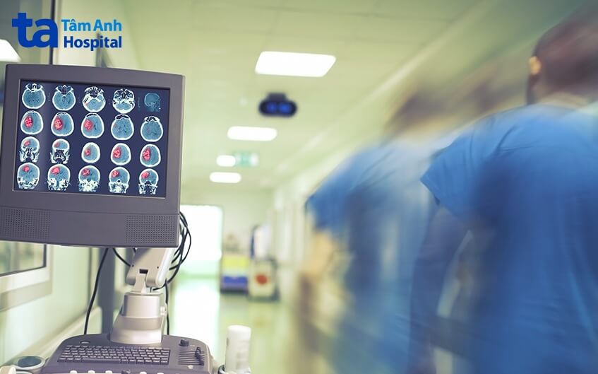 Tư vấn mổ u não đột quỵ xuất huyết não bằng Robot trí tuệ nhân 