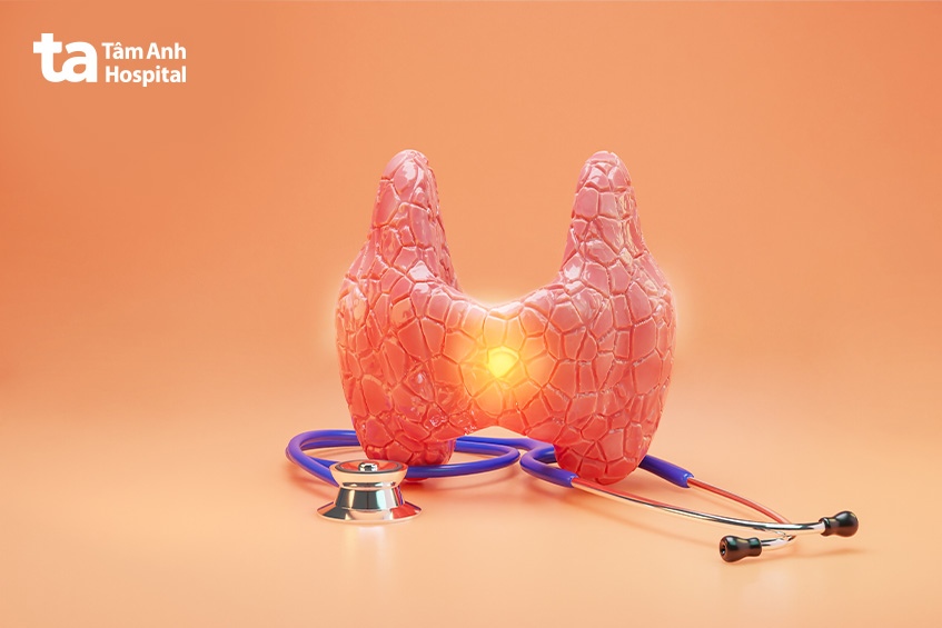 Xét nghiệm FNA tuyến giáp hỗ trợ phát hiện bệnh hạch lympho