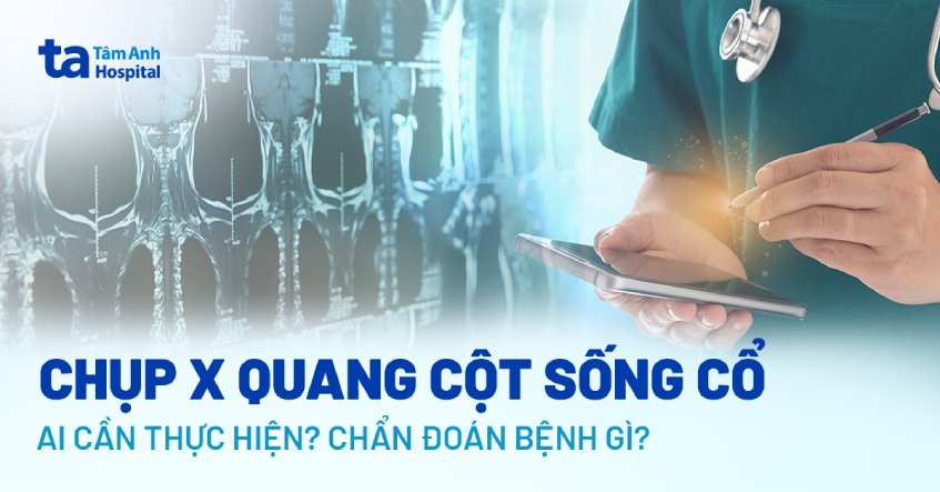xquang cột sống cổ