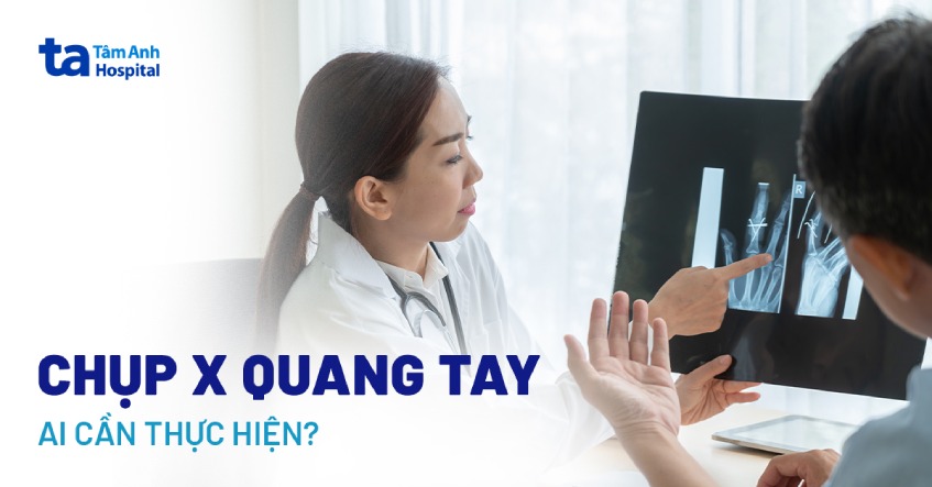chụp x-quang tay