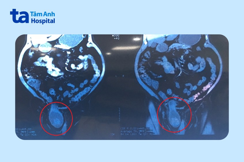 ảnh chụp ct bệnh nhân