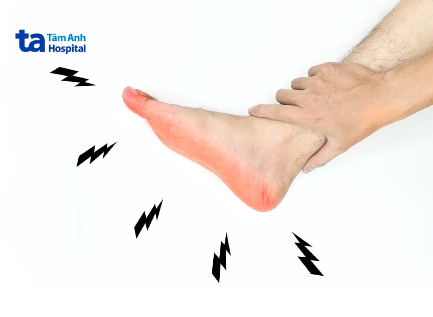 bệnh viêm dây thần kinh