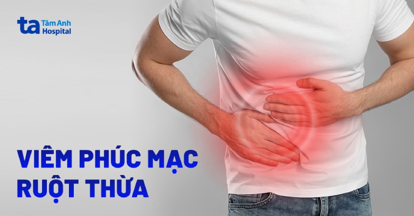 viêm phúc mạc ruột thừa là gì