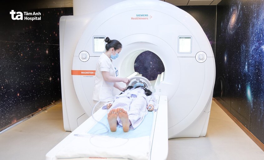 tầm soát đột quỵ để không hối tiếc