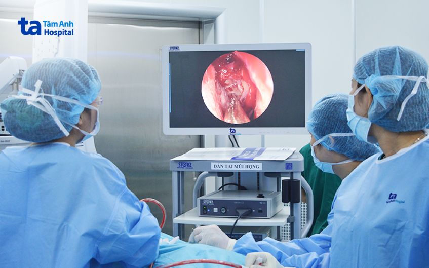 ca bệnh ổ nấm xoang