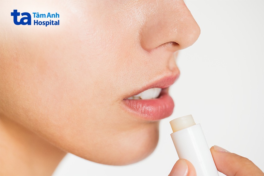 cách chữa viêm môi tróc vảy