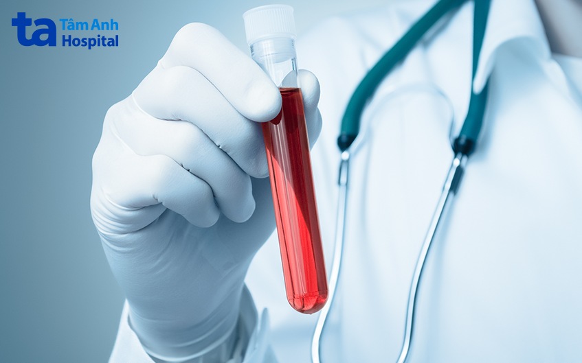 chẩn đoán tinh hoàn lệch bên thấp bên cao