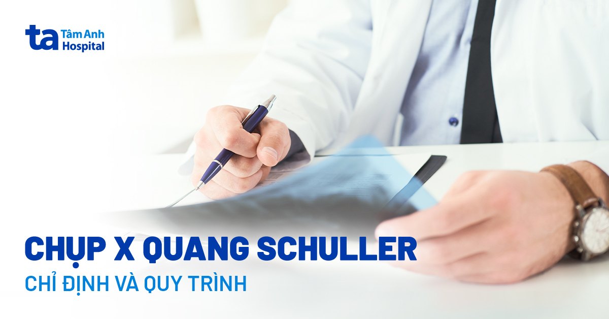 Chụp x quang schuller: Chẩn đoán bệnh gì và quy trình ra sao?