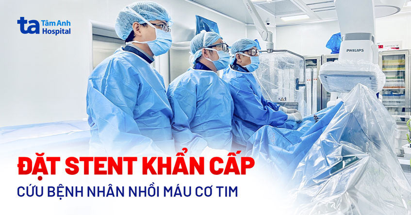 Tưởng động kinh, nhập viện phát hiện nhồi máu cơ tim nguy kịch